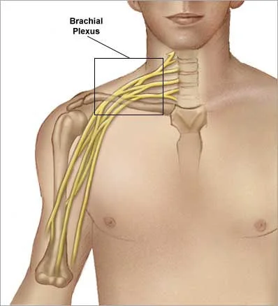 Brakial Pleksus Rehabilitasyonu